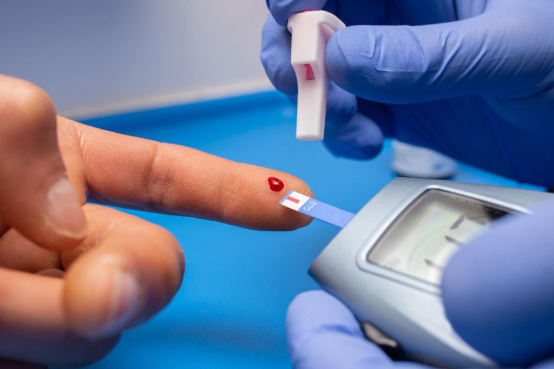 Complete Guide to Fasting Glucose Testing